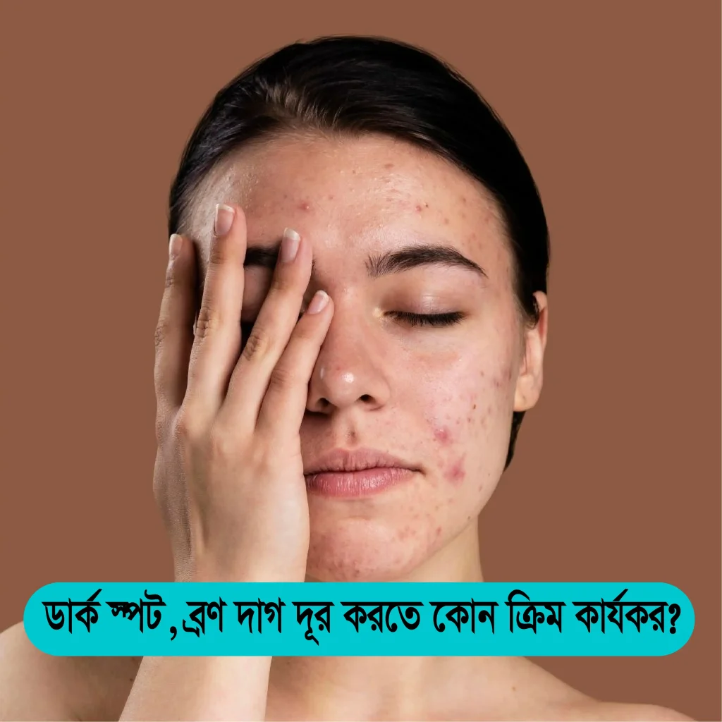 ডার্ক স্পট ব্রণ দাগ দূর করার ক্রিম 2025